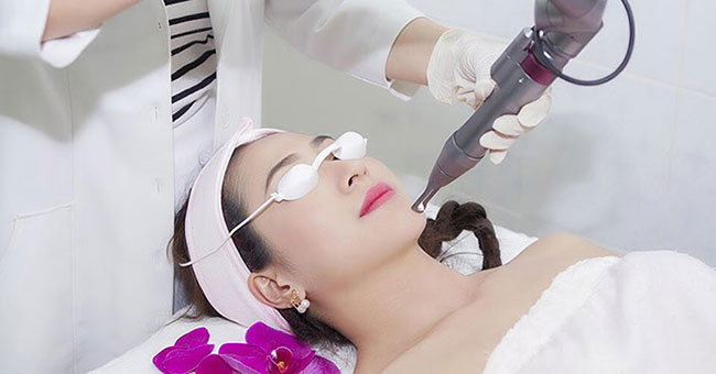 Điều trị nám bằng laser