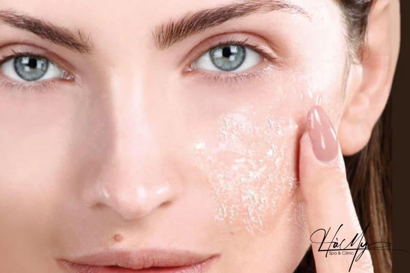 Có Nên Peel Da Tại Spa Hay Không? Địa Chỉ Peel Da Uy Tín 7 Peel da mang lại cho bạn làn da hết mụn - mờ thâm - trắng hồng (Nguồn: Internet)