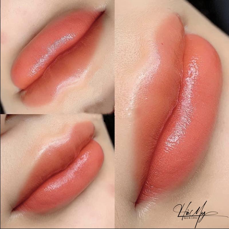 Phun Môi Xí Muội - Lựa Chọn Tuyệt Vời Cho Làn Môi Đẹp Quyến Rũ 10 Phun môi xí muội tại Hamy Spa sẽ cho kết quả môi đẹp như ý (Nguồn: Hamy Spa)