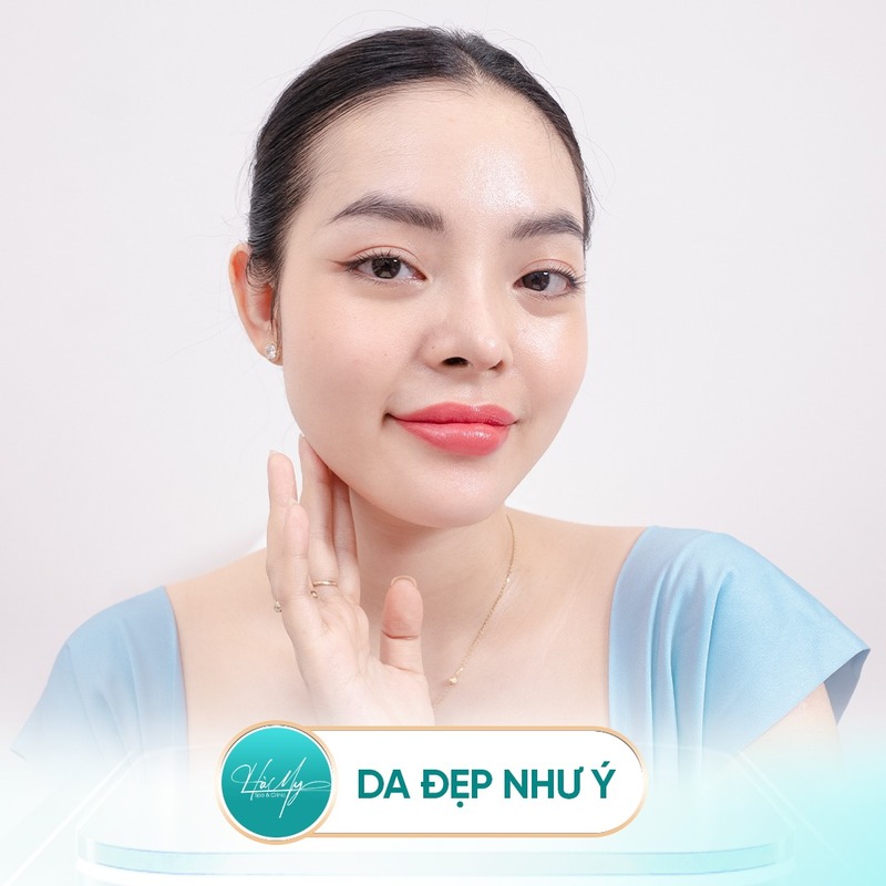 Tiêm Meso Căng Bóng Da Lợi ích, Ưu Nhược Điểm Và Lời Khuyên 5 Tiêm meso căng bóng da gần như phù hợp với mọi người (Nguồn: Hà My Spa)