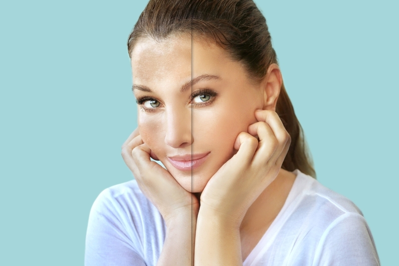 Tiêm Meso Trị Nám - Độ Hiệu Quả Và Đáng Tin Cậy Cho Làn Da Mượt Mà Và Sáng Bóng 7 Trị nám da bằng phương pháp tiêm meso có rất nhiều ưu điểm (Nguồn: Internet)