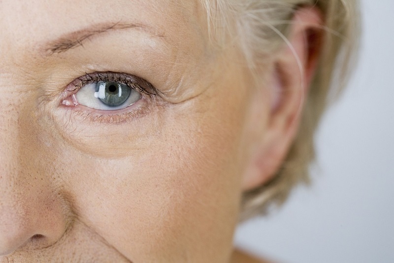 Tiêm Xóa Nhăn Mắt - Xóa Thâm, Làm Đầy Hốc Mắt Hiệu Quả 6 Tiêm Botox xóa nhăn mắt (Nguồn: Internet)