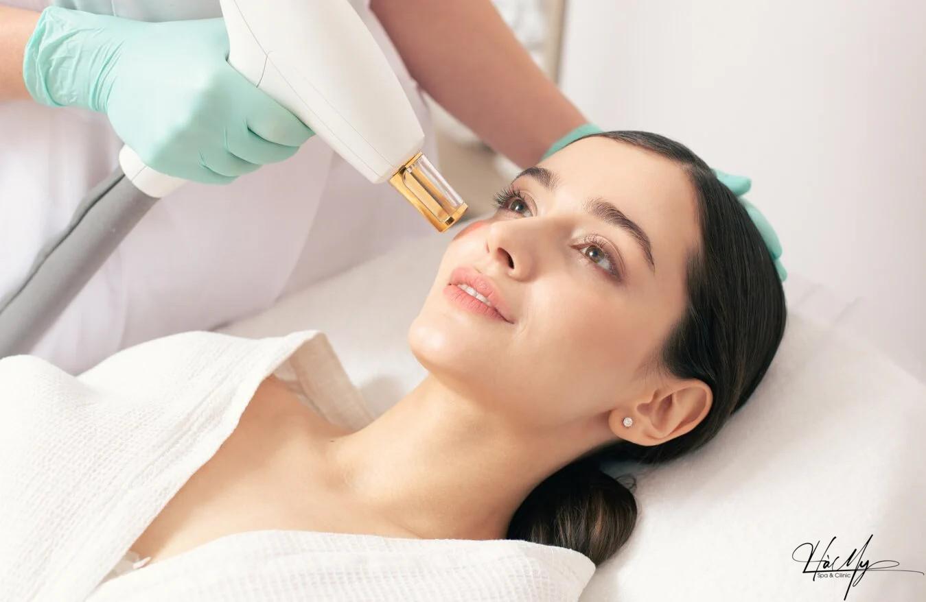 Có nên trị nám bằng laser không? Những điều bạn cần biết. 6 Điều trị nám bằng laser (Nguồn:Internet)