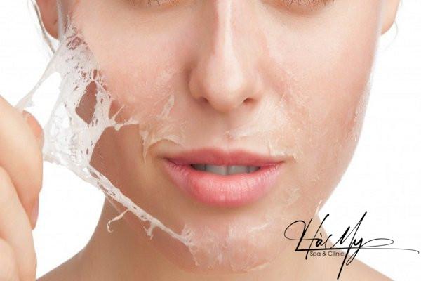 Peel da có đẩy mụn không? Tìm hiểu về hiệu quả và tác động của peel da đối với mụn 6 Peel da có đẩy mụn không (Nguồn:Internet)