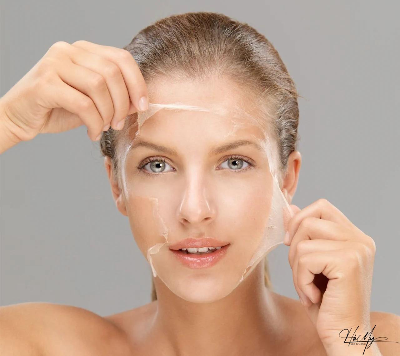 Peel da có đẩy mụn không? Tìm hiểu về hiệu quả và tác động của peel da đối với mụn 4 Peel da có đẩy mụn không (Nguồn:Internet)
