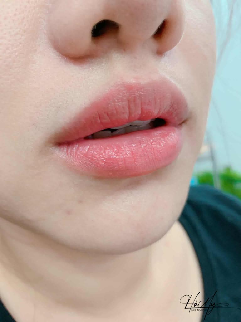 Xăm môi mấy ngày hết sưng? - Cách xử lý hiệu quả 5 Xăm môi mấy ngày hết sưng (Nguồn:Internet)