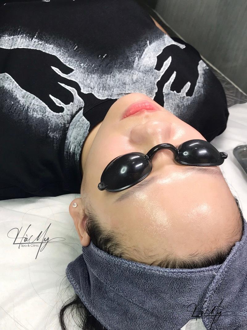 Kỹ Thuật Tiêm Mesotherapy Cách Để Da Mặt Đẹp - An Toàn 10 Kỹ thuật tiêm Meso mang lại nhiều lợi ích trong lĩnh vực làm đẹp (Nguồn: Hamy Spa)