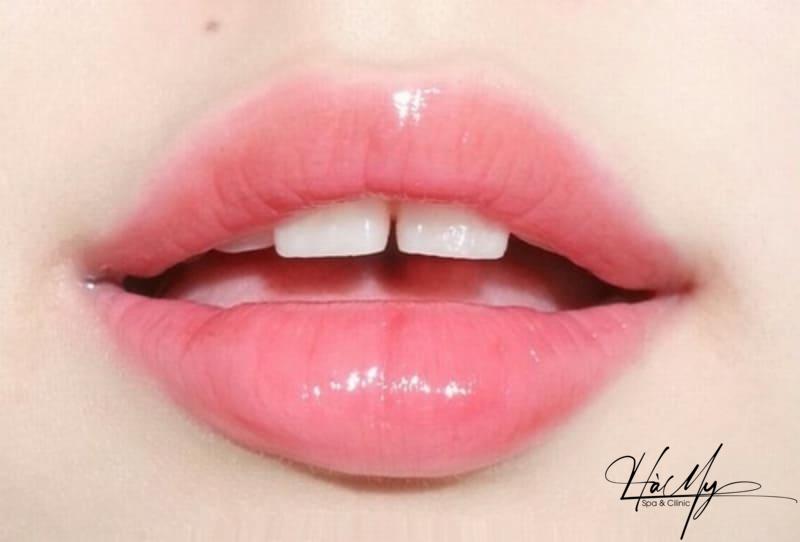 Phun Môi Pha Lê Căng Mọng Hồng Hào 7 Phương pháp phun môi pha lê phù hợp với những người có đôi môi kém sắc (Nguồn: Internet)
