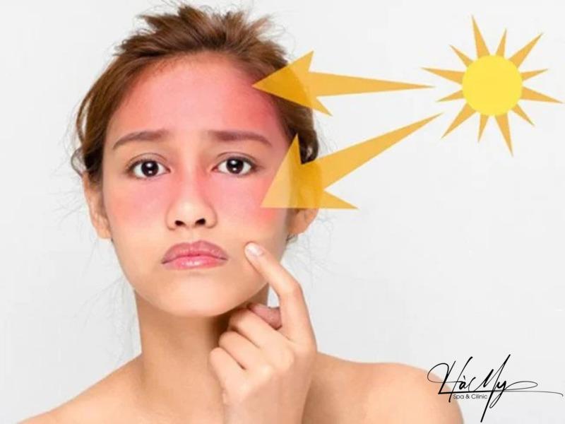 Cách trị nám mảng hiệu quả mà bạn nên biết 8 Không che chắn kỹ lưỡng khi ra ngoài vào buổi sáng dễ gây tình trạng nám da (Nguồn: Internet)