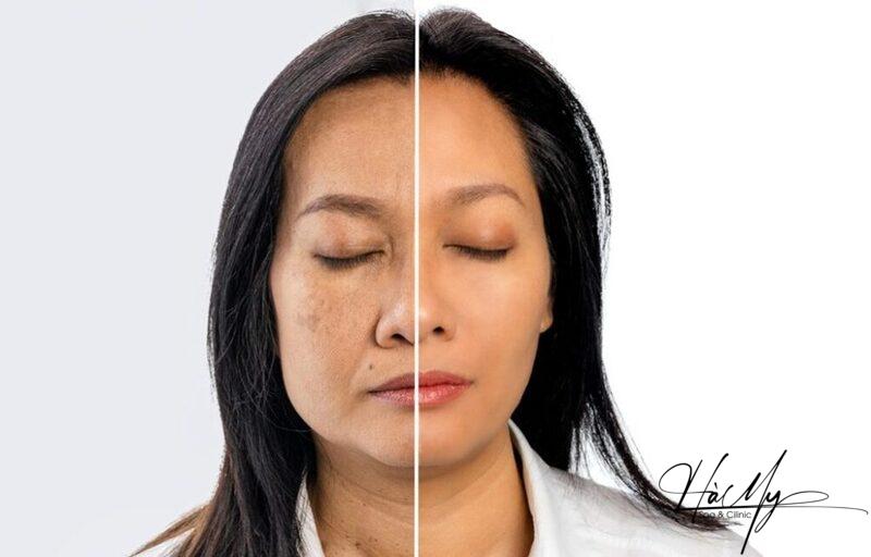 Peel Da Bằng Retinol Có Tác Dụng Gì, Quy Trình An Toàn Như Thế Nào? 7 Retinol giúp làm chậm quá trình lão hoá da (Nguồn: Internet)
