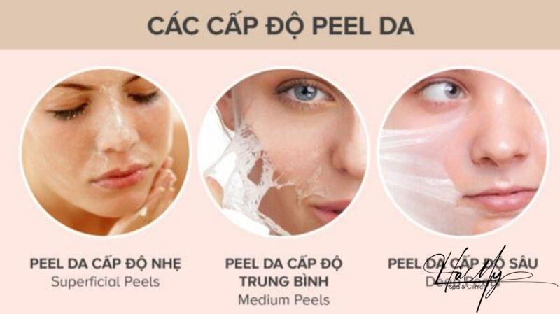 Peel da có trắng không? Tất tần tật những điều cần biết 5 Các bước peel làm trắng da được dùng cho từng tình trạng da (Nguồn: Internet)