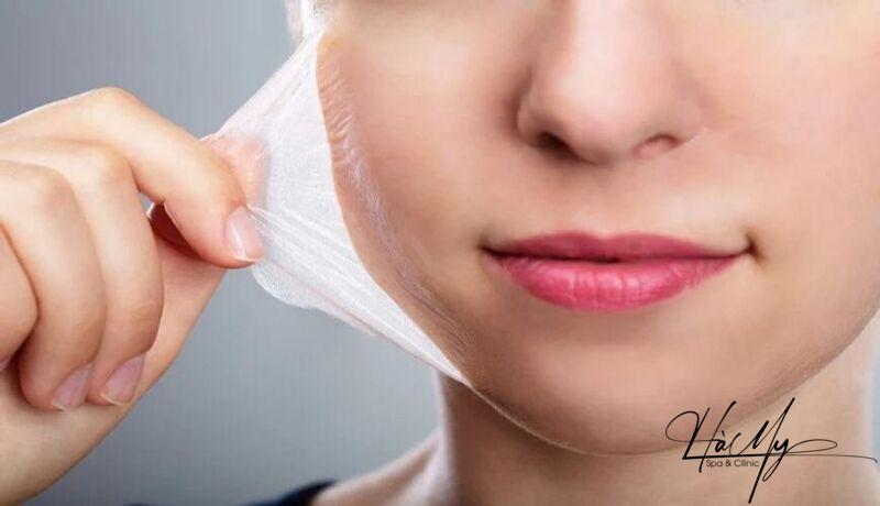 Peel da có trắng không? Tất tần tật những điều cần biết 8 Peel da là phương pháp giúp tái tạo da trắng (Nguồn: Internet)