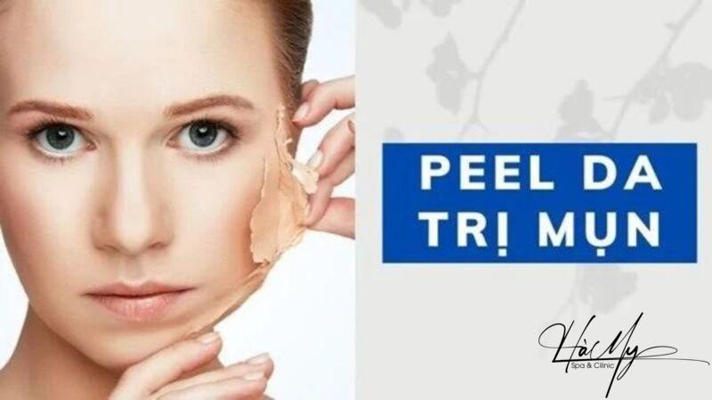 Peel da trị mụn ẩn có hết không? Sự thật đằng sau là gì? 4 Peel da là phương pháp làm đẹp sử dụng các chất hóa học để tác động lên bề mặt da (Nguồn: Internet)