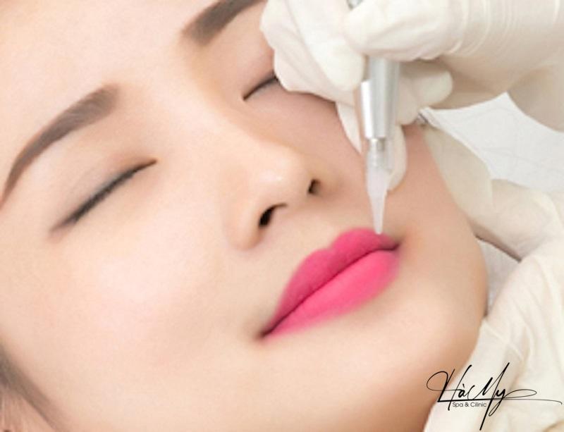 Phun môi màu hồng cánh sen - Bí quyết có bờ môi đẹp 7 Phun môi màu hồng cánh sen cần thực hiện trên quy trình khoa học (Nguồn: Internet)