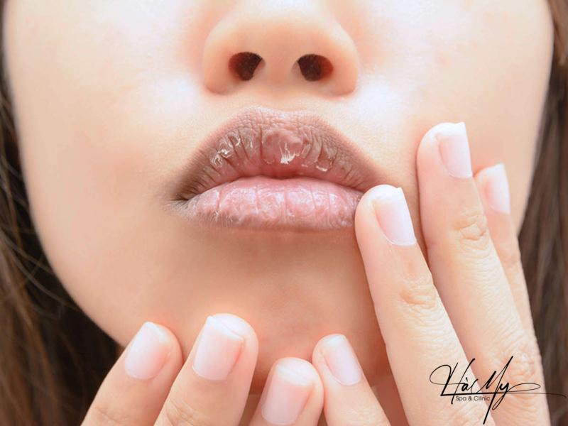 Nguyên nhân và cách khắc phục hiệu quả phun môi xong bị thâm đen 6 Chăm sóc không đúng cách, sử dụng mỹ phẩm kém chất lượng sẽ khiến đôi môi của bạn trở nên thâm đen và bong tróc (Nguồn: Internet)