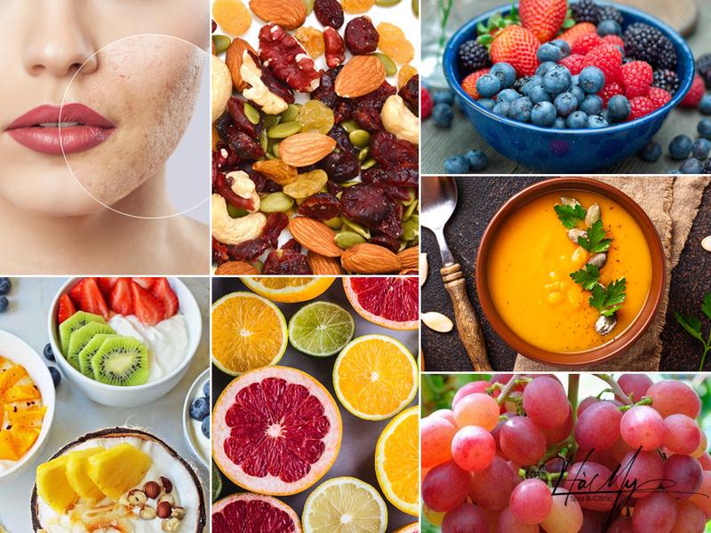 Ăn gì để giảm mụn ẩn? - Hiệu quả nhanh chóng 5 Ăn gì để giảm mụn ẩn (Nguồn: Internet)