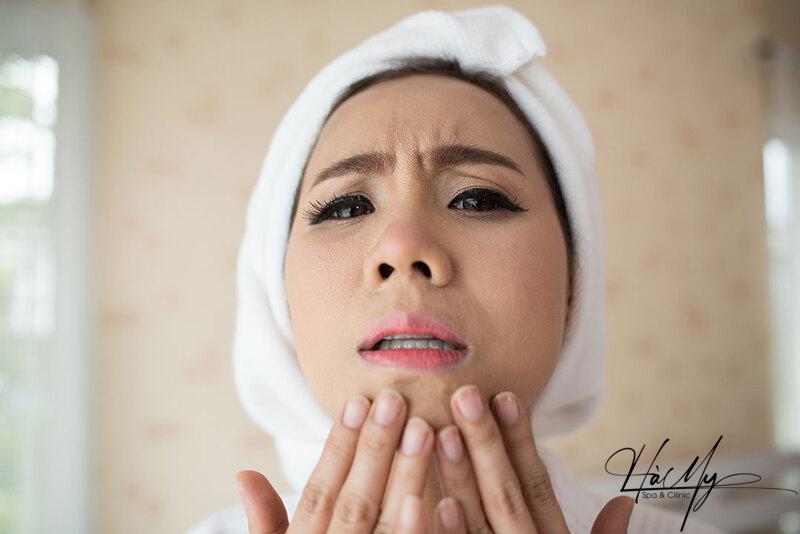 5 cách đẩy mụn ẩn hiệu quả và an toàn 8 Nguyên nhân gây ra mụn ẩn (Nguồn: Internet)