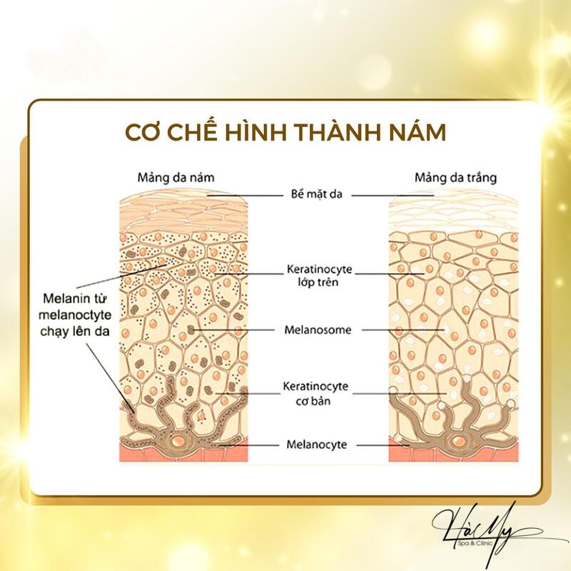 Cơ chế điều trị nám - Bí quyết giúp bạn sở hữu làn da trắng sáng 8 Cơ chế hình thành nám (Nguồn: Internet)