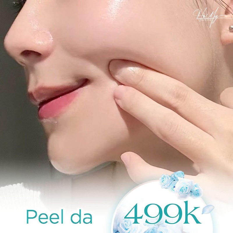 Dịch vụ Peel da, Chemical Peel uy tín - Bảng giá Peel da mới nhất 7 Ưu đãi khi peel da tại Hà My Spa (Nguồn: Hà My Spa )