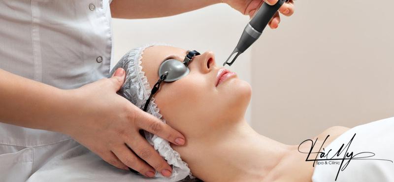 Điều trị nám bằng laser có hiệu quả không? 6 Điều trị nám bằng laser là phương pháp hiện đại (Nguồn: Internet)