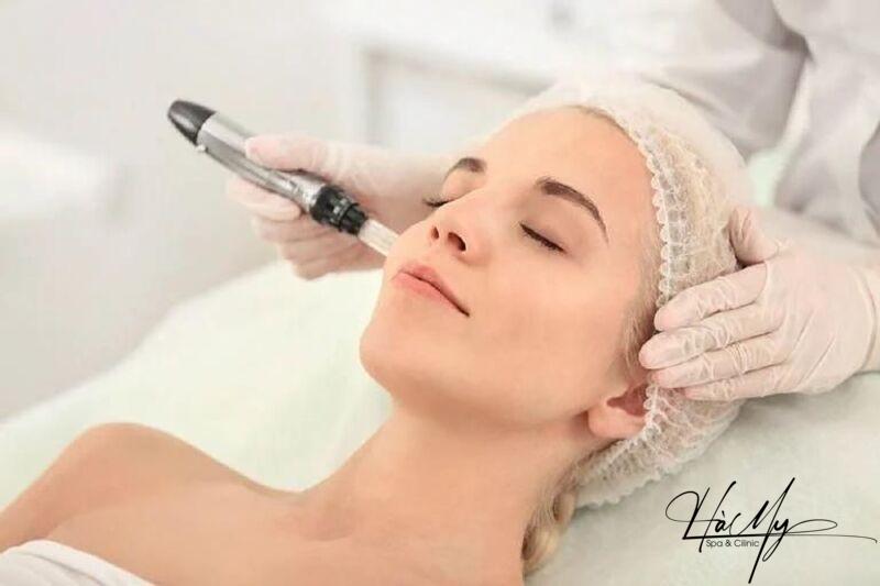 Điều trị nám bằng laser có hiệu quả không? 9 Điều trị nám bằng laser với địa chỉ uy tín , trang thiết bị hiện đại (Nguồn: Internet)