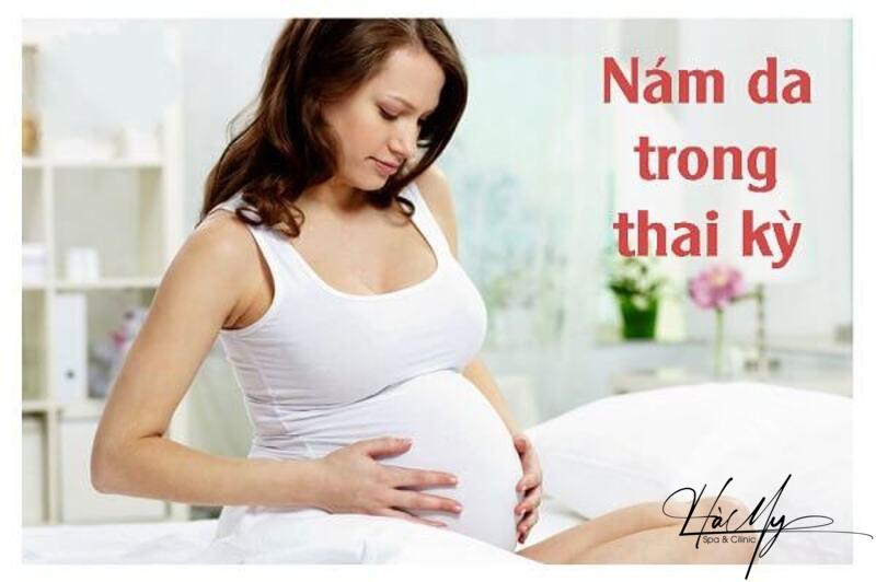 Điều trị nám da cho bà bầu - Những điều cần biết 6 Nám da trong thời kì mang bầu thì làm sao (Nguồn: Internet)