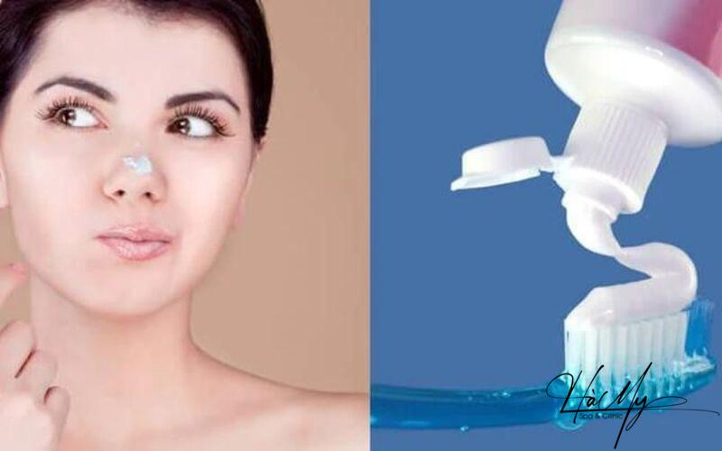 12 lời khuyên trị mụn đơn giản mà hiệu quả 24 Kem đánh răng có thể khiến vùng da quanh nốt mụn bị khô (Nguồn: Internet)