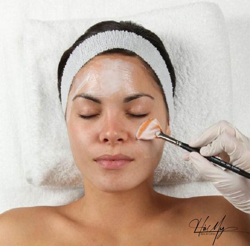 Peel da mụn có hiệu quả không? Ưu nhược điểm của Peel da mụn 5 Peel da mụn là dùng các chất hóa học để loại bỏ nguyên nhân gây ra mụn (Nguồn: Internet)