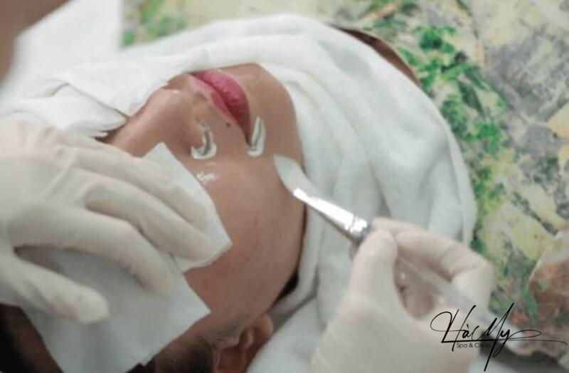 Peel da mụn có hiệu quả không? Ưu nhược điểm của Peel da mụn 6 Peel da có tác dụng điều trị nhiều loại mụn (Nguồn: Internet)