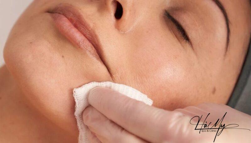 Quy trình Peel da và cách chăm sóc chuẩn 8 Peel da hướng tới cải thiện các vấn đề da, đem đến làn da sáng mịn và rạng ngời (Nguồn: Internet)