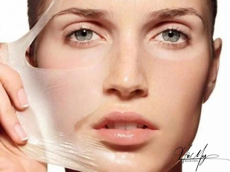 Tác Hại Của Peel Da Mà Bạn Nên Biết 5 Tác hại của peel da mà bạn cần biết (Nguồn: Internet)