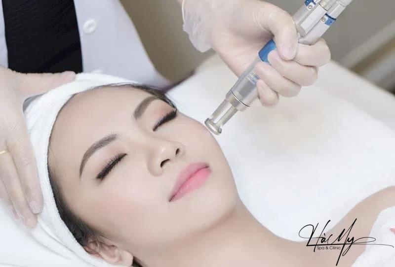 Bắn laser trị nám bao lâu thì hết? Hiệu quả ra sao? 7 Trị nám bằng laser có hết hẳn? (Nguồn: Internet)