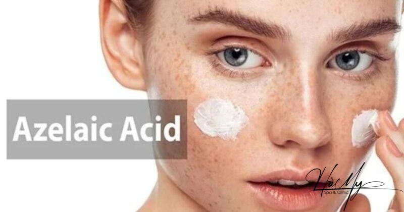 Các hoạt chất điều trị nám và lưu ý khi sử dụng 9 Axit azelaic – Thành phần trị nám phổ biến (Nguồn: Internet)