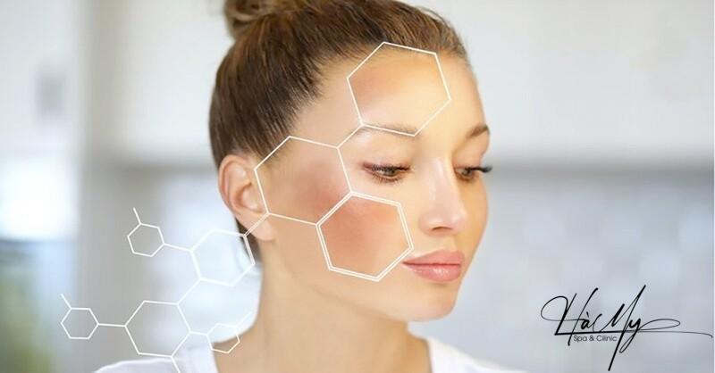 Các loại laser trị nám tốt nhất hiện nay 7 Các loại laser trị nám hiện nay (Nguồn: Hà My Spa)