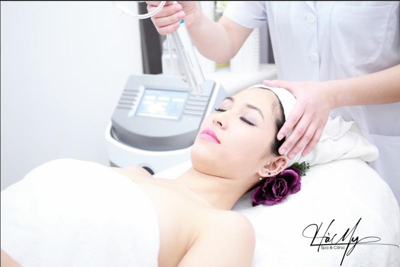Các loại laser trị nám tốt nhất hiện nay 9 Trị nám bằng công nghệ Laser Yag (Nguồn: Hà My Spa)