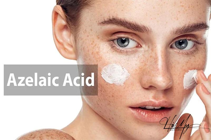 Mụn trứng cá là gì? Một số lưu ý trong quá trình điều trị mụn trứng cá 6 Axit Azelaic hỗ trợ làm sáng cho làn da đều màu (Nguồn: Internet)