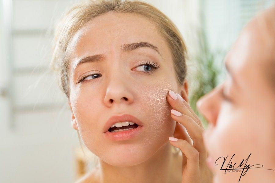 10 cách phòng tránh mụn trứng cá hiệu quả 9 Hạn chế trang điểm khi bị mụn trứng cá (Nguồn: Internet)