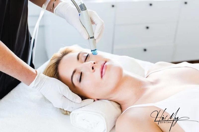 Mụn trứng cá đỏ: Dấu hiệu nhận diện và cách điều trị hiệu quả 11 Điều trị mụn trứng cá đỏ bằng công nghệ cao (Nguồn: Internet)