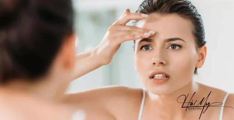 Mụn trứng cá ở trán - Nguyên nhân và cách điều trị triệt để 8 Bạn nên rửa mặt hai lần một ngày để giảm mụn trứng cá ở trán (Nguồn: Internet)
