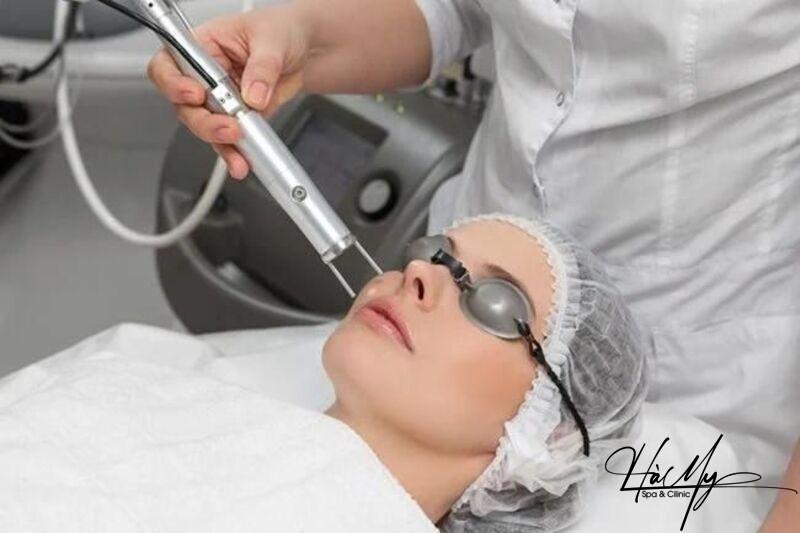 Spa trị nám tàn nhang uy tín ở Hà Tĩnh 4 Được hưởng các chương trình khuyến mãi, ưu đãi ở Hà My Spa & Clinic (Nguồn: Ha My Spa)