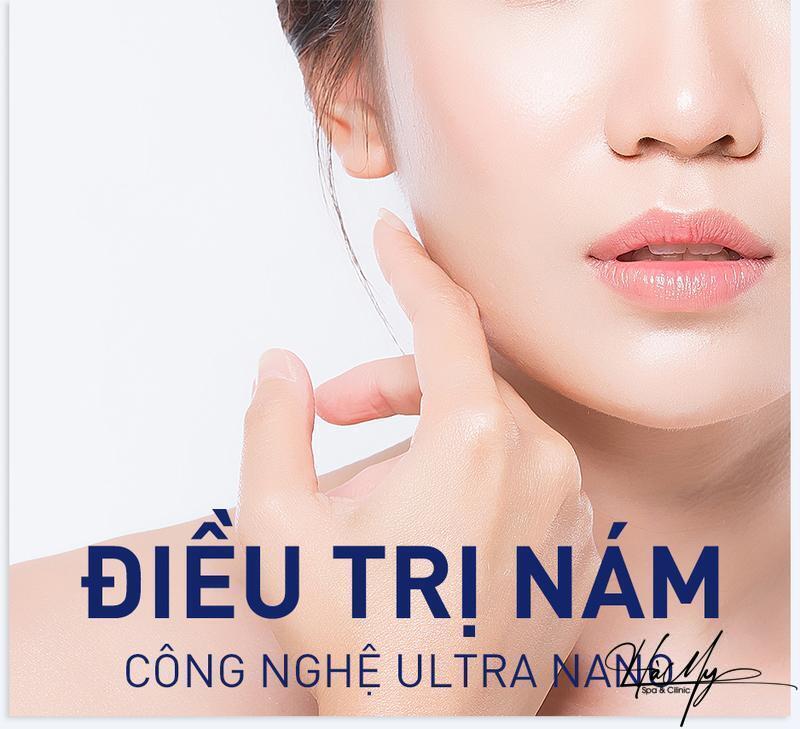 8 Cách điều trị nám bằng lá trầu không đơn giản hiệu quả 12 Điều trị nám với công nghệ hiện đại tại Hà My Spa & Clinic(Nguồn: Hà My Spa)