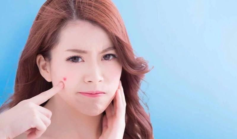 Cách Gom Cồi Mụn Nhanh Chóng An Toàn Hiệu Quả 8 Thuốc bôi kết hợp thuốc uống trị mụn kiểm xoát mụn (Nguồn: Internet)