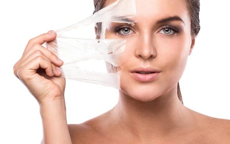 Bị Mụn Có Peel Da Được Không? Hướng Dẫn An Toàn 6 Không nên nặn mụn khi peel da (Nguồn: Internet)
