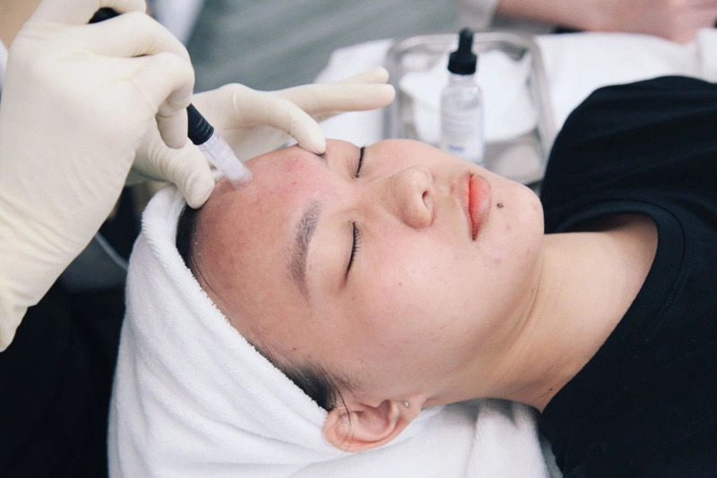 Phương Pháp Tiêm Meso Điều Trị Mụn Cho Làn Da Sạch Mụn, Trẻ Hóa 9 Giúp da duy trì trạng thái khỏe mạnh và giảm nguy cơ hình thành mụn mới (Nguồn: Internet)