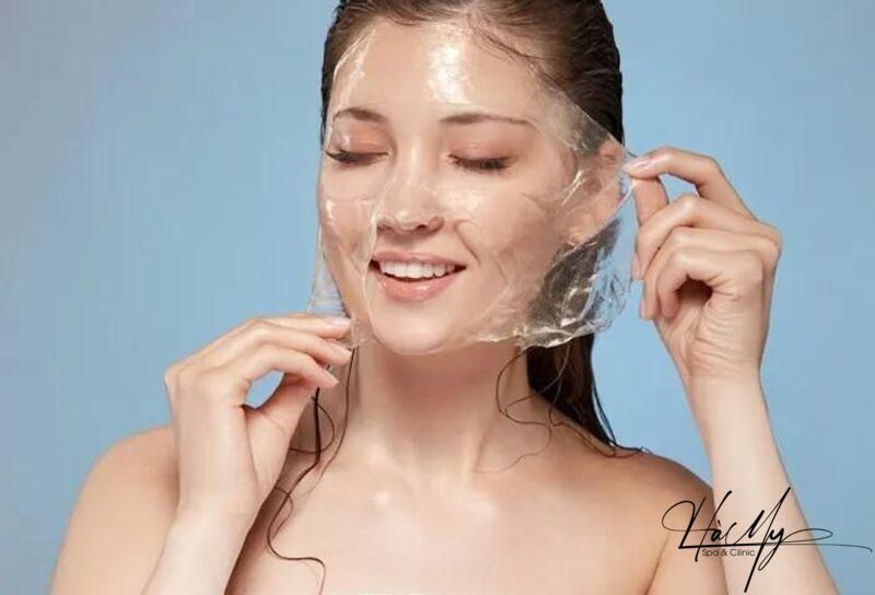 5 Địa chỉ spa peel da trị nám Hà Tĩnh uy tín nhất 6 Nám nỗi ám ảnh của nhiều người (Nguồn: Internet)
