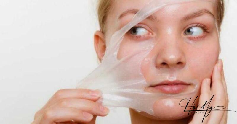 5 Địa chỉ spa peel da trị nám Hà Tĩnh uy tín nhất 8 Loại bỏ nám và tái tạo da mặt một cách tự nhiên (Nguồn: Internet)