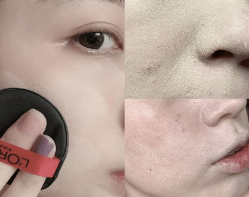 Bị Mụn Ẩn Mãi Không Khỏi? Đã Có Giải Pháp Hiệu Quả Ngay Tại Đây! 12 Hình ảnh trang điểm dễ bị mốc nền (Nguồn: Internet)