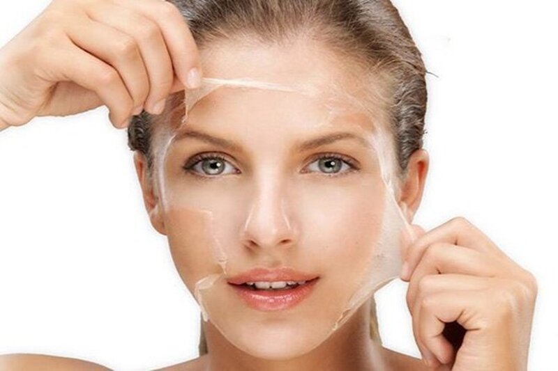 Cách Trị Mụn Bọc Sưng Đỏ Hiệu Quả: Hướng Dẫn A-Z 2024 15 Peel da loại bỏ lớp da chết (Nguồn: Internet)