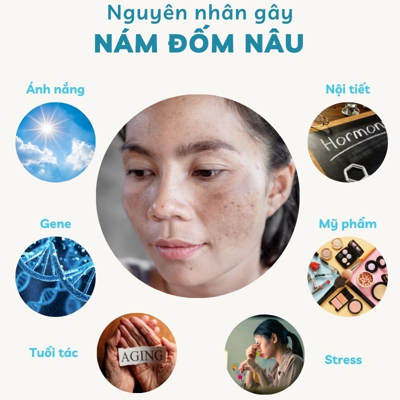 Nguyên nhân gây nám đốm nâu (Nguồn: Internet)