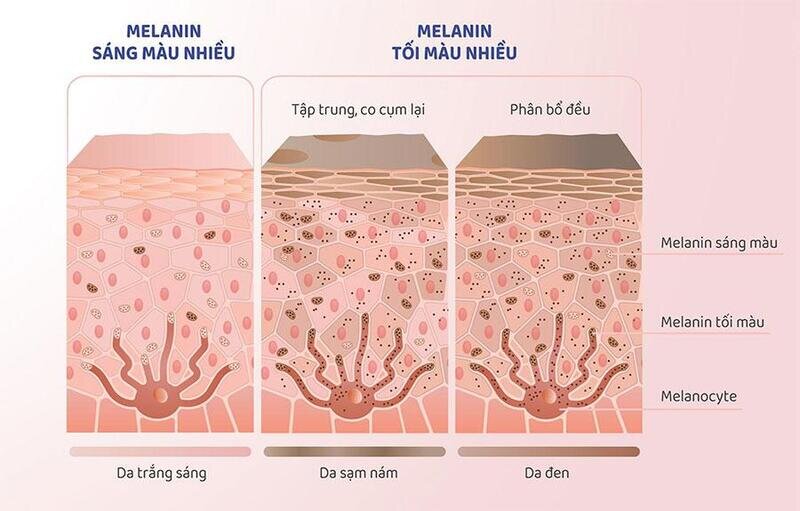 Da Sạm Màu Bất Thường - Kẻ Thù Của Làn Da Rạng Rỡ 7 Melanin là yếu tố quan trọng khiến da sạm màu bất thường (Nguồn: Internet)